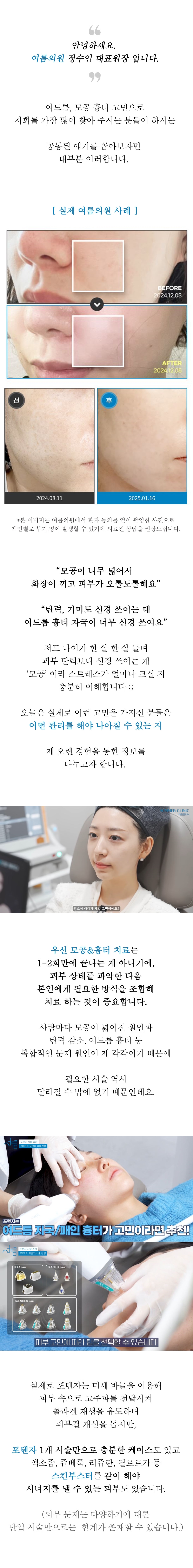 강남포텐자